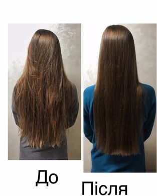 Купить Набор комплексного ухода за жирным типом волос Hillary Perfect Hair Green Tea в Украине